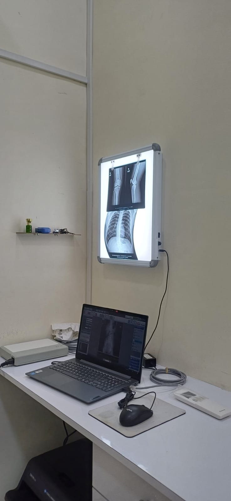 X-ray viewing workstation at Mekhale Diagnostic Centre